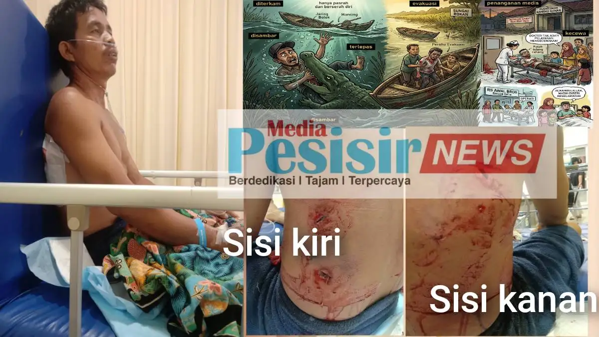 BREAKING NEWS.!!! Nelayan Rohil Selamat Diterkam Buaya, Berikut Kronologi Lengkap Kejadian di Sungai Rokan